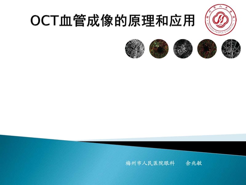 OCT血管成像的原理和应用.ppt_第1页