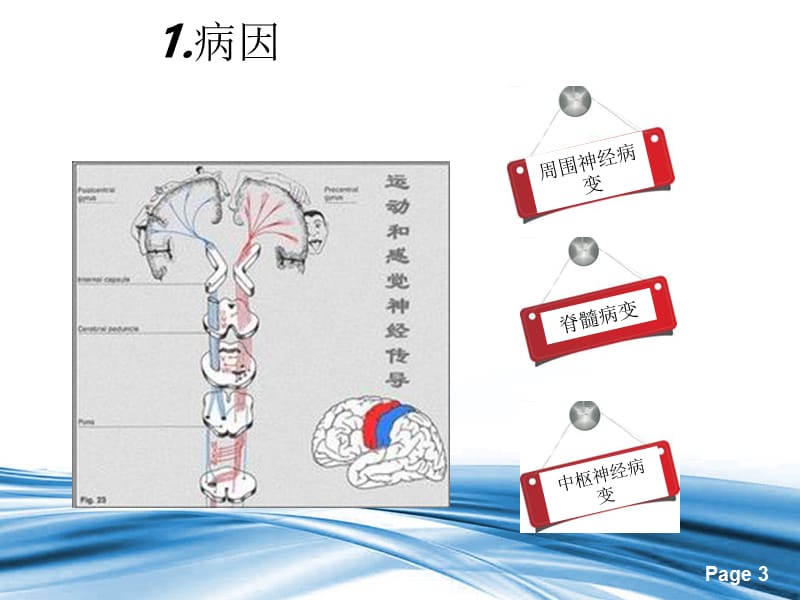 下肢感觉障碍相关疾病鉴别ppt课件.ppt_第3页