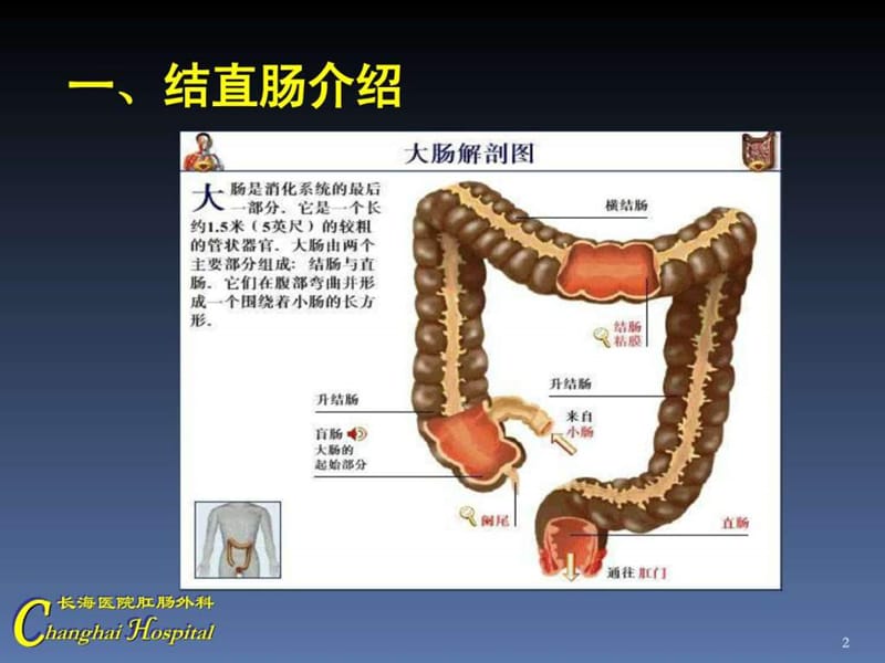 直肠癌PPT_图文.ppt.ppt_第2页