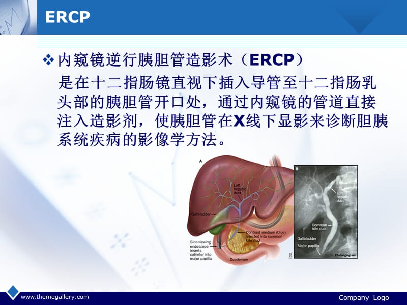 ercp诊疗与并发症ppt课件.ppt_第2页