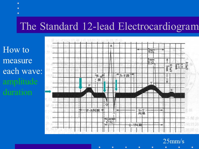 ECG心电图的解读.ppt_第3页