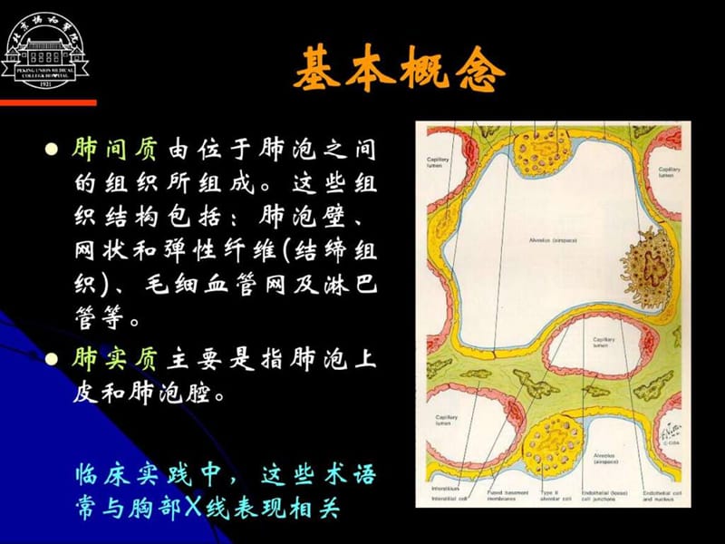 DPLD诊断和治疗--讲义-(徐作军).ppt_第2页