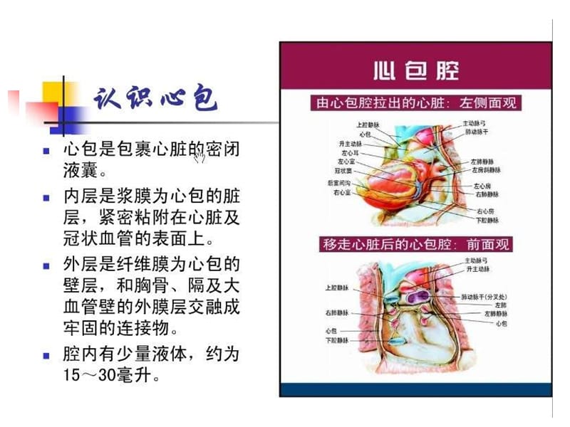 心包压塞时外科干预时机的选择.ppt_第2页