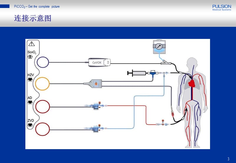 picco参数解读已看两遍,很好ppt课件.ppt_第3页