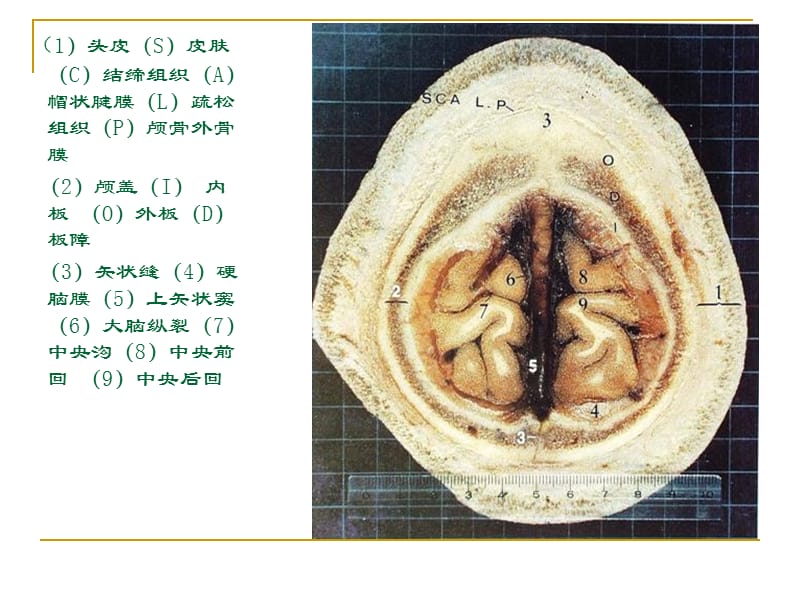 人体断层解剖图谱(大脑)PPT课件.ppt_第3页
