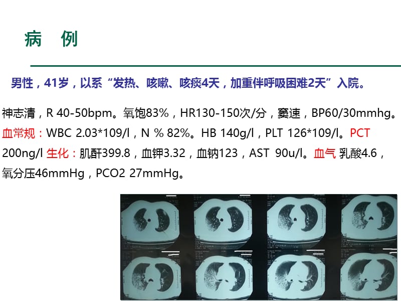 esbls的耐药机制及抗菌药物应用原则ppt课件.ppt_第2页