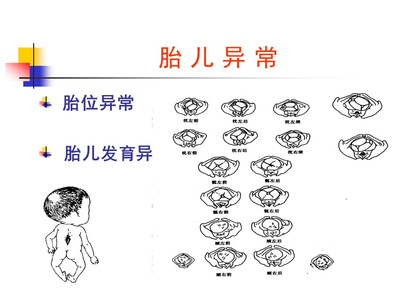 《发生在病房的》PPT课件.ppt_第3页