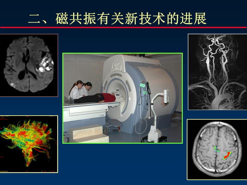 《mr进展与解剖》ppt课件.ppt_第1页