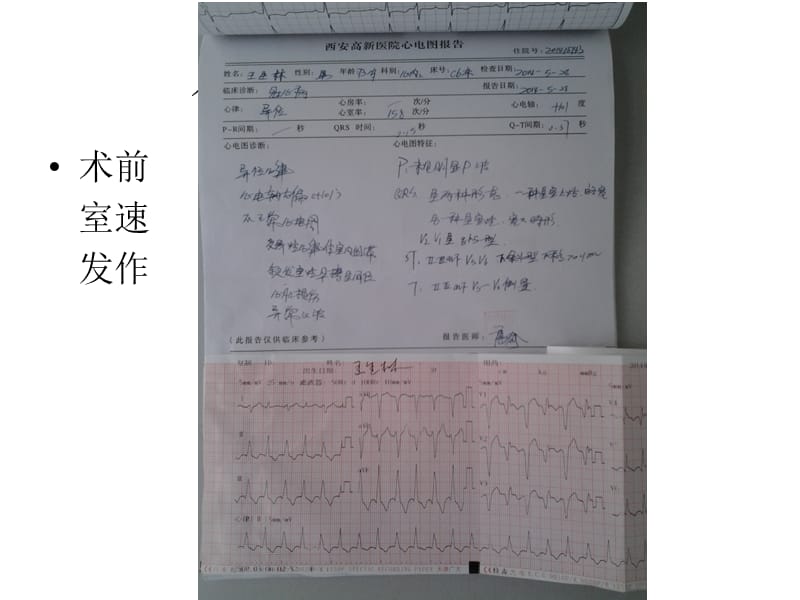 《分叉病变处理》ppt课件.ppt_第3页