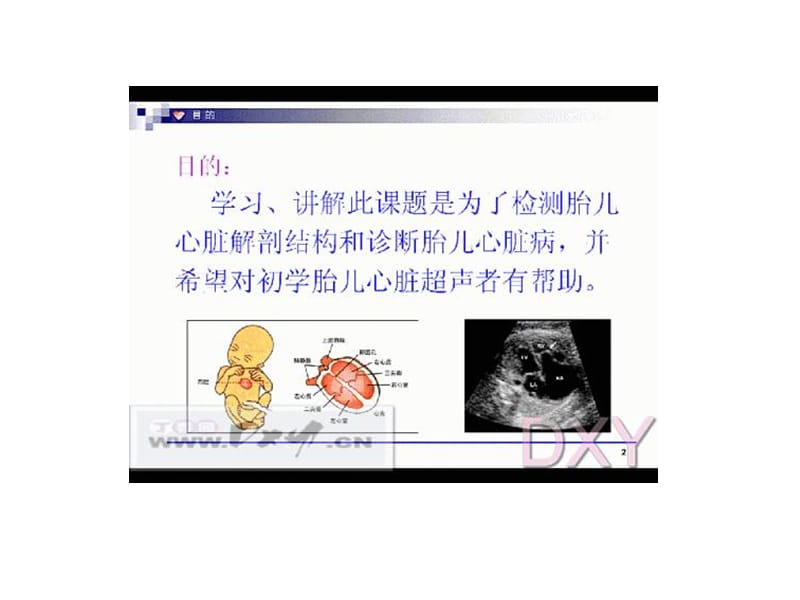 2019胎儿心脏解剖结构的超声判定.ppt_第3页