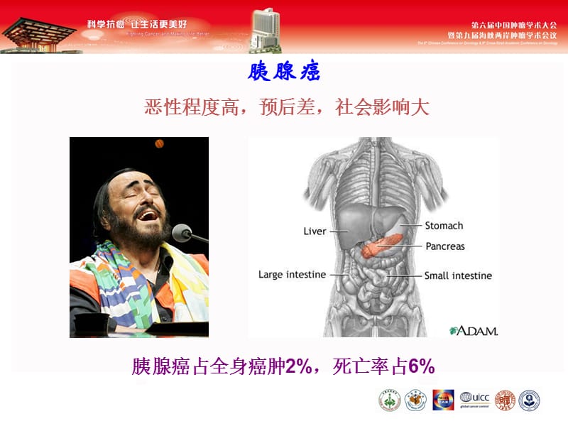 2019胰腺癌的诊治现状及展望.ppt_第2页