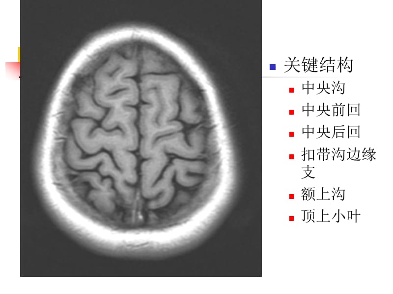 颅脑MRI横断层解剖PPT课件.ppt_第2页