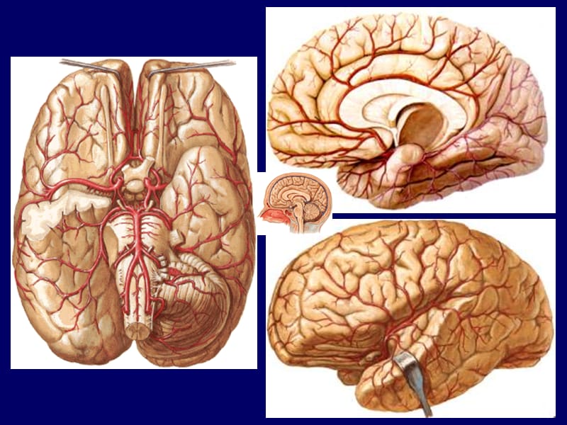 2019脑血管影像解剖.ppt_第3页