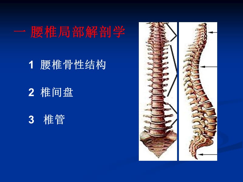 2019腰椎结核的CT诊断与鉴别.ppt_第2页