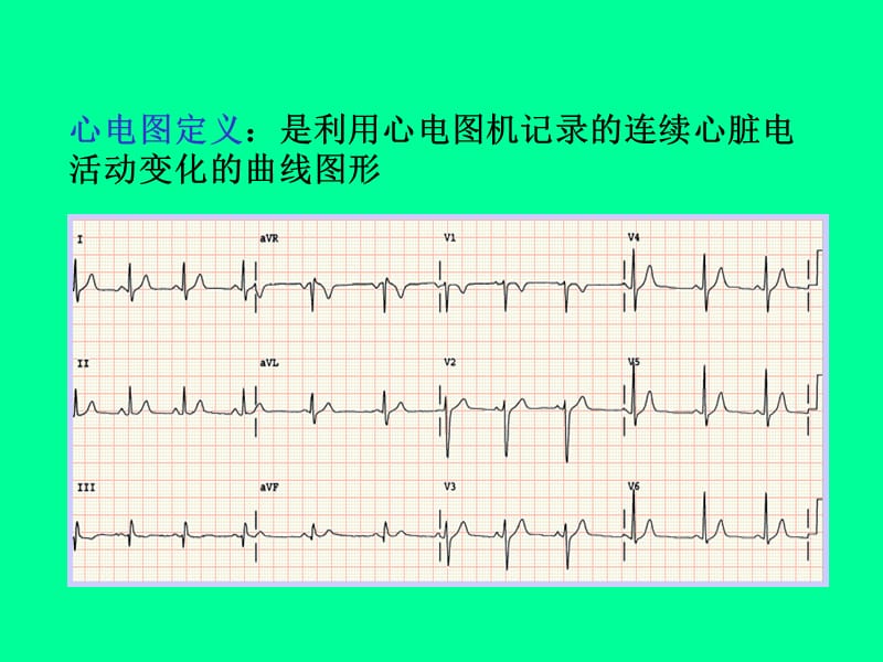 2019诊断学（实验）心电图教学.ppt_第3页