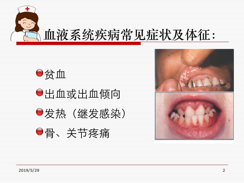 2019血液科疾病常见症状护理.ppt_第2页