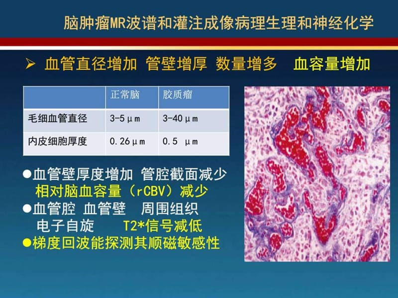 2019脑肿瘤磁共振波谱MRS和PWI灌注成像_图文.ppt.ppt_第3页