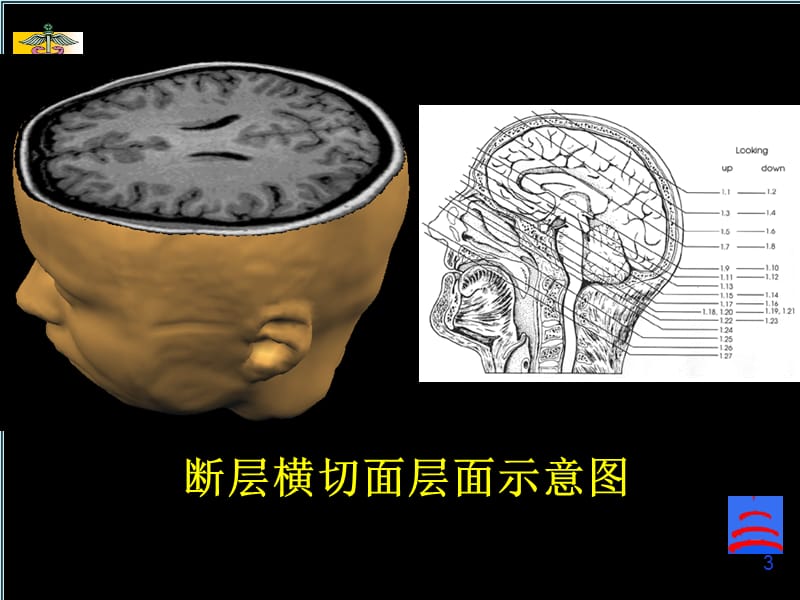 脑磁共振局部解剖与功能图谱PPT课件.ppt_第3页