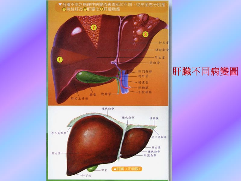 2019脂肪肝.ppt_第2页