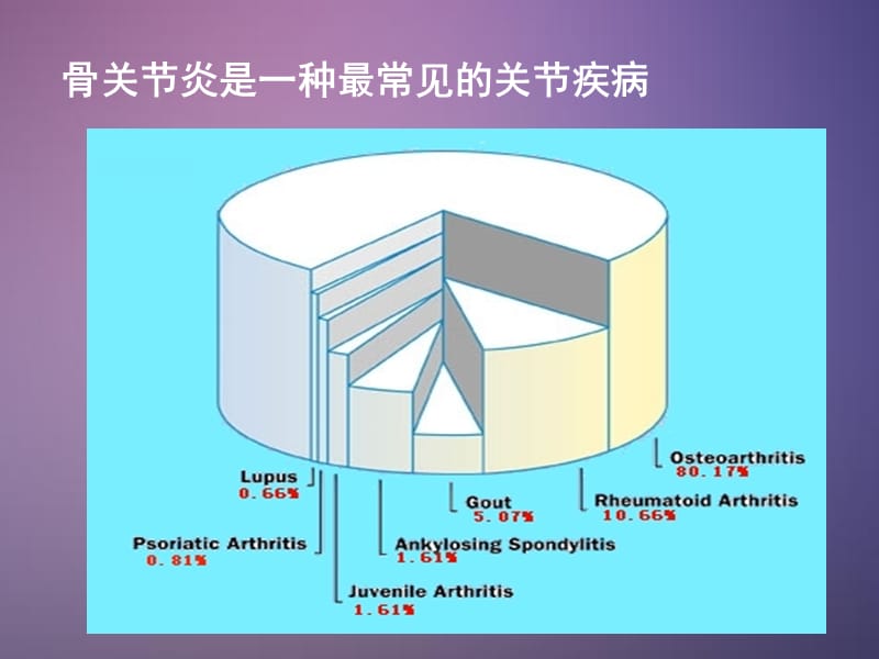 《骨关节炎》ppt课件.ppt_第2页