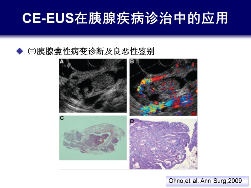 2019造影增强EUS与胰腺疾病诊治(4).ppt_第1页