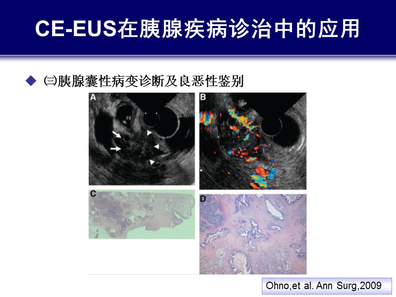 2019造影增强EUS与胰腺疾病诊治(4).ppt_第2页