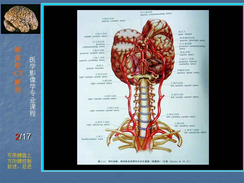 脑血管CT解剖PPT课件.ppt_第2页