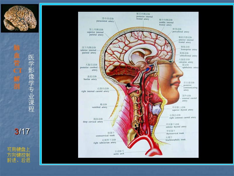 脑血管CT解剖PPT课件.ppt_第3页