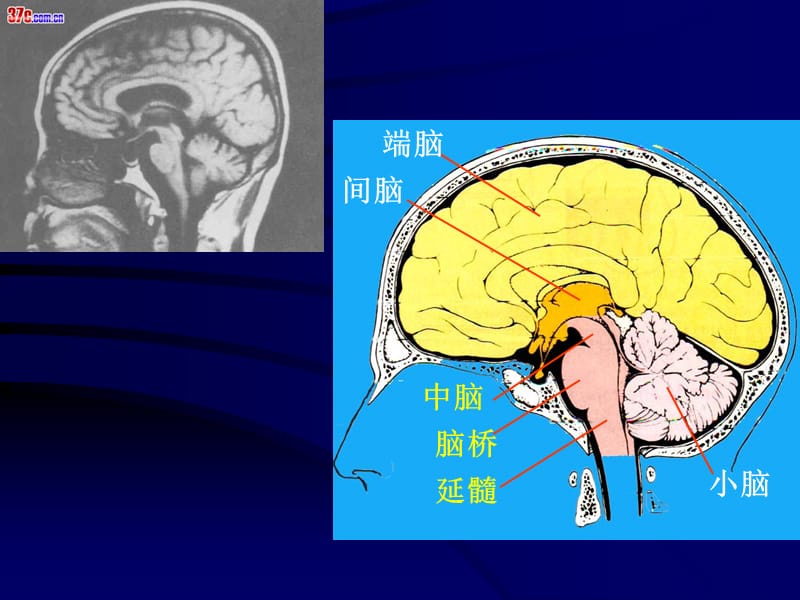 脑和脑神经PPT课件.ppt_第3页