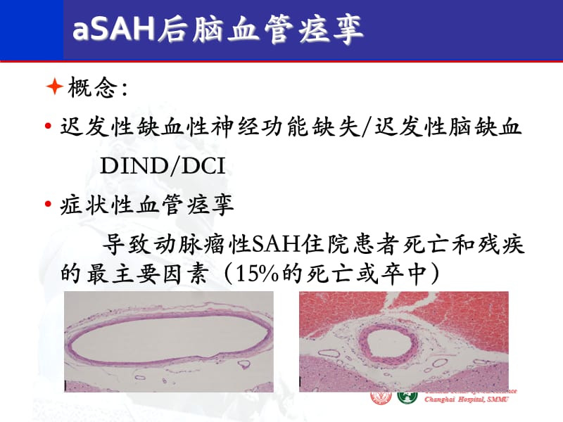 2019脑血管痉挛的诊疗规范和介入治疗.ppt_第3页