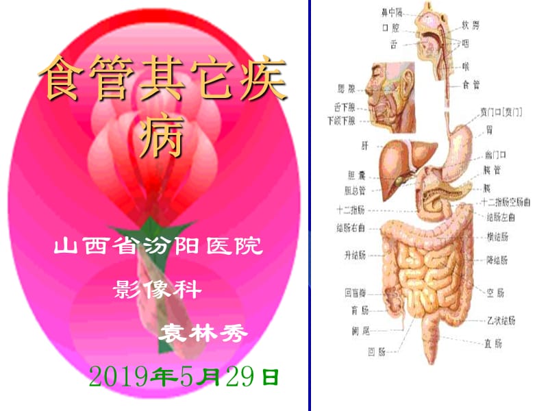 《食管其它疾病》ppt课件.ppt_第1页