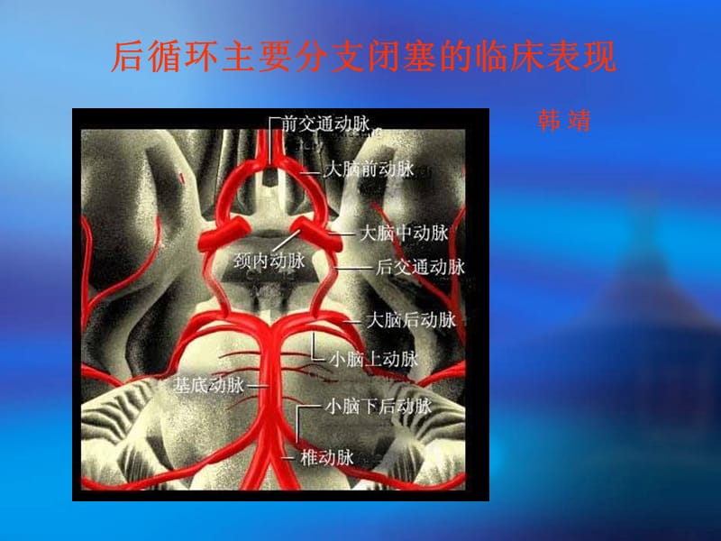 后循环主要分支闭塞的临床表现ppt课件.ppt_第1页