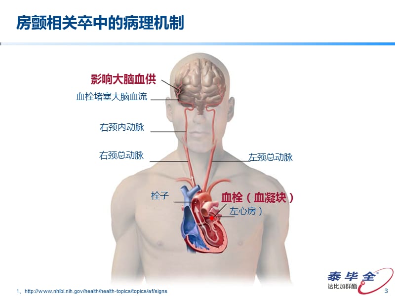 房颤卒时中预防抗凝治疗ppt课件.ppt_第3页