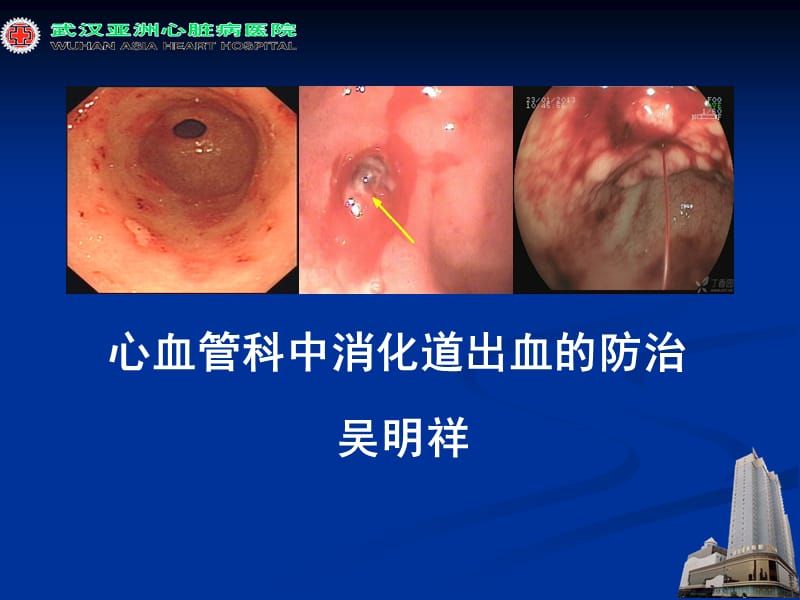 心血管疾病中消四化道出血的防治ppt课件.ppt_第1页