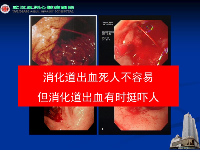 心血管疾病中消四化道出血的防治ppt课件.ppt_第2页