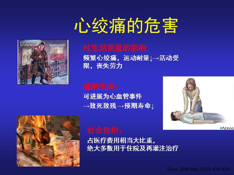 心绞痛治的疗新进展2ppt课件.ppt_第3页