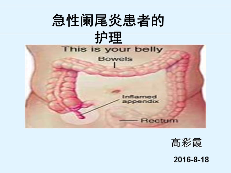 急性阑尾炎对患者的护理-PPT课件2.ppt_第1页