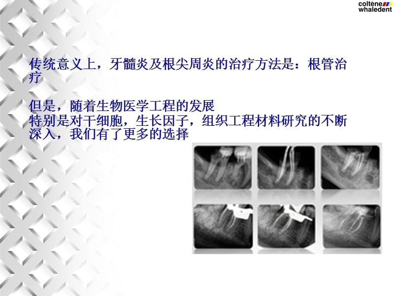 牙髓血运重建术p三pt课件.ppt_第2页