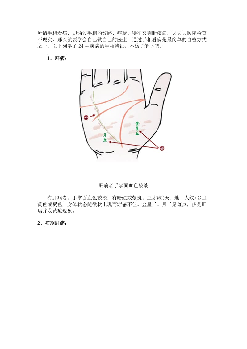 所谓手相看病.doc_第1页