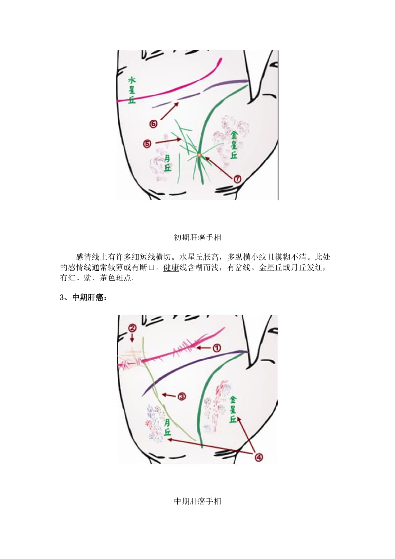 所谓手相看病.doc_第2页