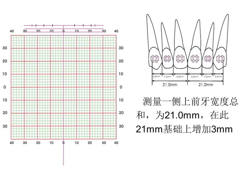 弓丝训练1ppt课件.ppt_第2页