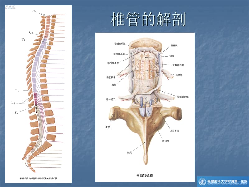 椎管肿瘤的mr诊断你ppt课件.ppt_第2页