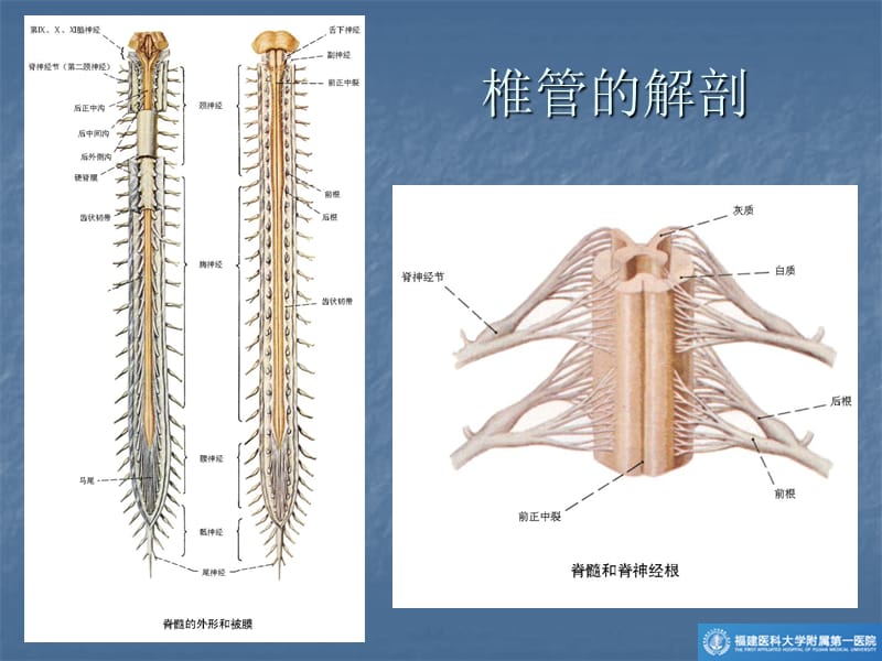 椎管肿瘤的mr诊断你ppt课件.ppt_第3页