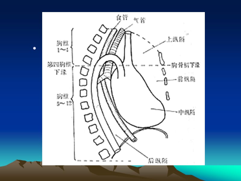 纵隔肿瘤影像诊断.的ppt课件.ppt_第3页