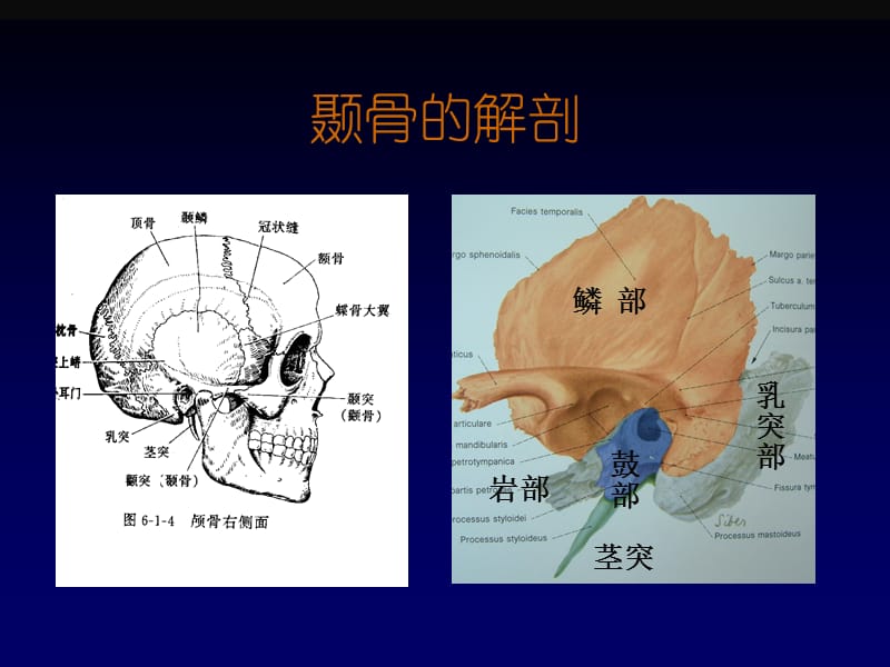 耳解剖、非分化脓性中耳炎3ppt课件.ppt_第3页