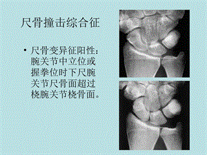 腕关节损伤m点r征象ppt课件.ppt