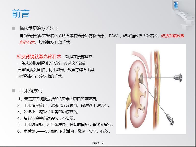 输尿管结石患者的点护理查房ppt课件.ppt_第3页