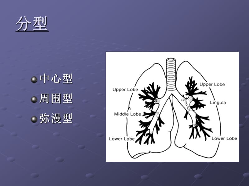 肺癌影像诊断讲课时ppt课件.ppt_第2页