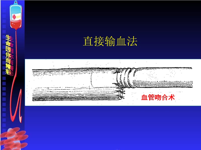 输血严重危害上shotppt课件.ppt_第3页