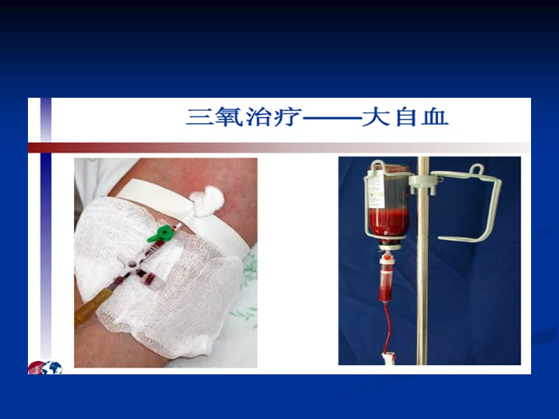 臭氧的临阳床应用ppt课件.ppt_第3页